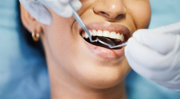 Best Emergency Dental Care for Broken or Chipped Teeth in Clearwater, KS